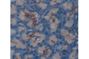 IHC-P analysis of Human Tissue, with DAB staining. (SEMA4B antibody  (AA 644-832))