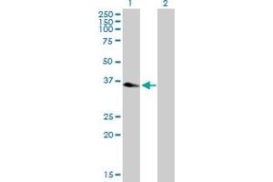 QTRT1 antibody  (AA 1-358)