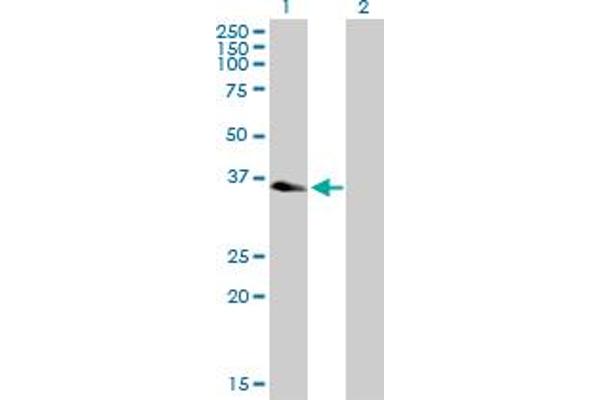 QTRT1 antibody  (AA 1-358)