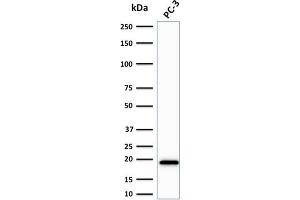 Western Blot Analysis of PC-3 cell lysate using NME2 / nm23-H2 Mouse Monoclonal Antibody (CPTC-NME2-2). (NME2 antibody)