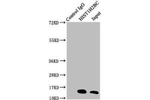 Western Blotting (WB) image for anti-Histone H2B (acLys20) antibody (ABIN7139170)
