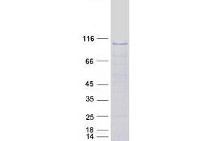 Validation with Western Blot (OSBPL7 Protein (Transcript Variant 1) (Myc-DYKDDDDK Tag))