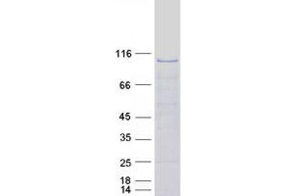 OSBPL7 Protein (Transcript Variant 1) (Myc-DYKDDDDK Tag)