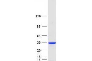 Validation with Western Blot (NQO1 Protein (Transcript Variant 1) (Myc-DYKDDDDK Tag))