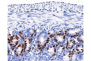 Immunohistochemistry analysis of paraffin-embedded mouse jejunum(intraperitoneal injection BrdU every 2 hours for 4 times) using Brdu Monoclonal Antibody at dilution of 1:300. (BrdU antibody)