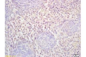 Formalin-fixed and paraffin embedded mouse embryo labeled with Rabbit Anti FLT3L Polyclonal Antibody, Unconjugated (ABIN1714763) at 1:200 followed by conjugation to the secondary antibody and DAB staining (FLT3LG antibody  (AA 61-160))