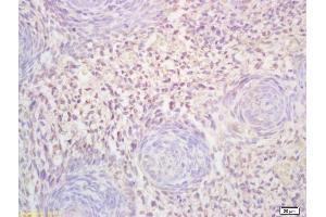 Formalin-fixed and paraffin embedded mouse embryo labeled with Rabbit Anti FLT3L Polyclonal Antibody, Unconjugated (ABIN1714763) at 1:200 followed by conjugation to the secondary antibody and DAB staining (FLT3LG antibody  (AA 61-160))