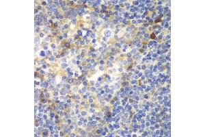 Immunohistochemistry of paraffin-embedded human amygdalitis using ZAP70 antibody. (ZAP70 antibody  (AA 1-300))