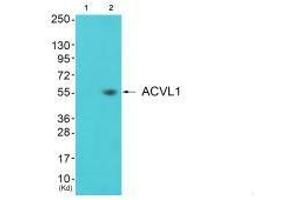 Western blot analysis of extracts from 3T3 cells (Lane 2), using ACVL1 antiobdy. (ACVRL1 antibody)