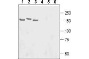 Western blot analysis of rat lung (lanes 1 and 4), rat brain (lanes 2 and 5) and hippocampus (lanes 3 and 6) lysates: - 1-3. (ADCY3 antibody  (3rd Extracellular Loop))
