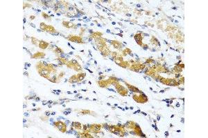 Immunohistochemistry of paraffin-embedded Human stomach using OGN Polyclonal Antibody at dilution of 1:100 (40x lens). (OGN antibody)