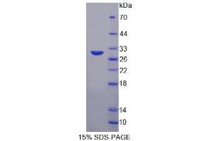 SDS-PAGE analysis of Human DPP3 Protein. (DPP3 Protein)