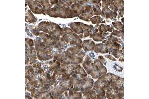 Immunohistochemical staining of human pancreas with TMED7-TICAM2 polyclonal antibody  shows strong cytoplasmic positivity in exocrine glandular cells.
