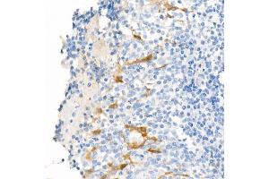 Immunohistochemistry of paraffin-embedded Human tonsil using  antibody (ABIN7265531) at dilution of 400 (40x lens). (ALDH1A1 antibody)