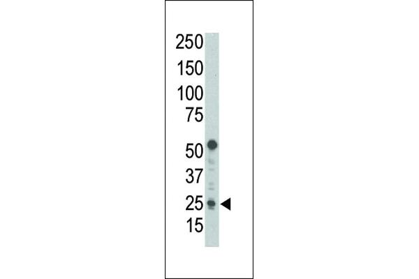 PUMA antibody  (AA 119-154)