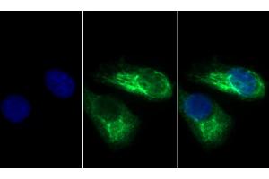 Detection of KRT33A in Human Hela cell using Polyclonal Antibody to Keratin 33A (KRT33A) (Keratin 33A antibody  (AA 57-363))