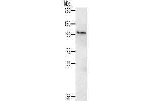 Gel: 6 % SDS-PAGE,Lysate: 40 μg,Primary antibody: ABIN7190553(EMC1 Antibody) at dilution 1/200 dilution,Secondary antibody: Goat anti rabbit IgG at 1/8000 dilution,Exposure time: 15 seconds (KIAA0090 antibody)