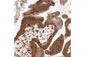 Immunohistochemical staining of human placenta with PITPNM2 polyclonal antibody  shows strong cytoplasmic and nuclear positivity in trophoblastic cells at 1:20-1:50 dilution. (PITPNM2 antibody)