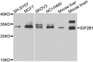 Western blot analysis of extracts of various cell lines, using EIF2B1 antibody.