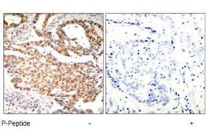 Image no. 1 for anti-Myocyte Enhancer Factor 2A (MEF2A) (pSer408) antibody (ABIN197081) (MEF2A antibody  (pSer408))
