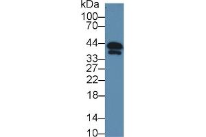 Western Blotting (WB) image for anti-Slow Skeletal Troponin T (TNNT1) (AA 1-261) antibody (ABIN7439144)