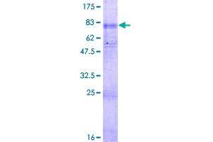 SLC22A5 Protein (AA 1-557) (GST tag)