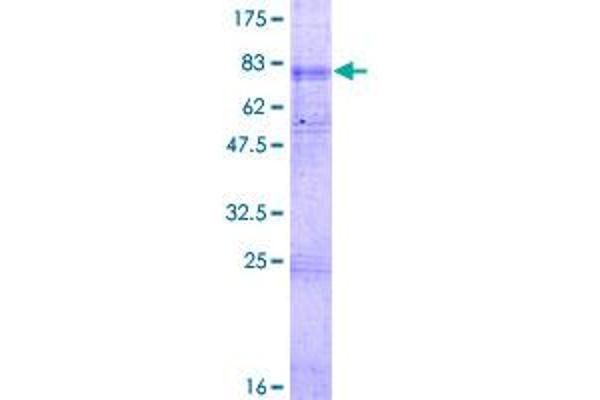 SLC22A5 Protein (AA 1-557) (GST tag)