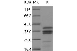 Cathepsin S (CTSS) (Active) protein (His tag)