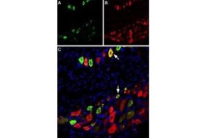 Multiplex staining of TRPV1 and NaV1. (TRPV1 antibody  (Cys616Ser-Mutant, Extracellular) (Atto 488))