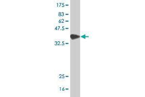 Western Blot detection against Immunogen (37 KDa) . (SAGE1 antibody  (AA 357-455))