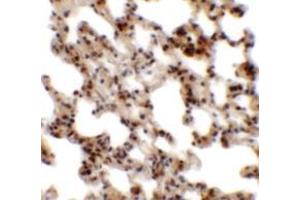 Immunohistochemistry of Coronin 7 in rat lung tissue with Coronin 7 antibody at 2. (Coronin 7 antibody  (C-Term))