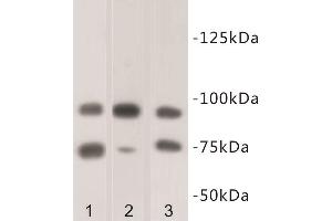 Western Blotting (WB) image for anti-SUZ12 Polycomb Repressive Complex 2 Subunit (SUZ12) antibody (ABIN1854978) (SUZ12 antibody)