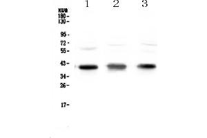 Western blot analysis of CCR4 using anti-CCR4 antibody . (CCR4 antibody)