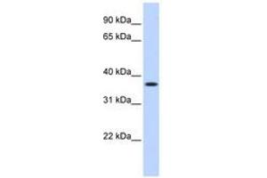 Image no. 1 for anti-Methylenetetrahydrofolate Dehydrogenase (NADP+ Dependent) 2, Methenyltetrahydrofolate Cyclohydrolase (MTHFD2) (AA 180-229) antibody (ABIN6740950)