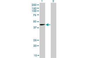 Western Blot analysis of SIRT2 expression in transfected 293T cell line by SIRT2 monoclonal antibody (M01), clone 4B11. (SIRT2 antibody  (AA 128-227))