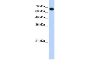 WB Suggested Anti-CCDC38 Antibody Titration: 0. (CCDC38 antibody  (N-Term))