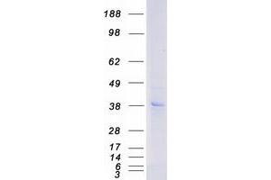 Validation with Western Blot (P2RY12 Protein (Transcript Variant 1) (Myc-DYKDDDDK Tag))