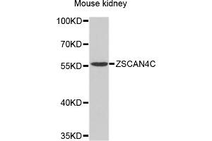 Western blot analysis of extracts of mouse kidney, using ZSCAN4 antibody (ABIN4905688) at 1:1000 dilution.