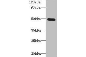 Western blot All lanes: TTYH1 antibody at 4 μg/mL + Raji whole cell lysate Secondary Goat polyclonal to rabbit IgG at 1/10000 dilution Predicted band size: 50, 27, 36 kDa Observed band size: 50 kDa (TTYH1 antibody  (AA 50-178))