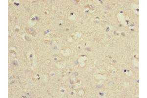 Immunohistochemistry of paraffin-embedded human brain tissue using ABIN7166579 at dilution of 1:100 (SLC2A13 antibody  (AA 564-648))