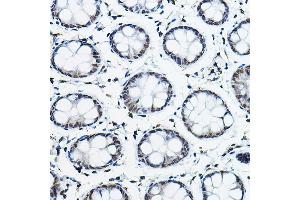 Immunohistochemistry of paraffin-embedded human colon using NCOR2 Rabbit pAb (ABIN6130575, ABIN6144422, ABIN6144423 and ABIN6224431) at dilution of 1:100 (40x lens). (NCOR2 antibody  (AA 670-900))