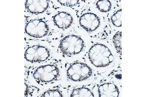 Immunohistochemistry of paraffin-embedded human colon using NCOR2 Rabbit pAb (ABIN6130575, ABIN6144422, ABIN6144423 and ABIN6224431) at dilution of 1:100 (40x lens). (NCOR2 antibody  (AA 670-900))
