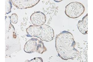 Image no. 4 for anti-Interleukin 15 (IL15) antibody (ABIN464931) (IL-15 antibody)