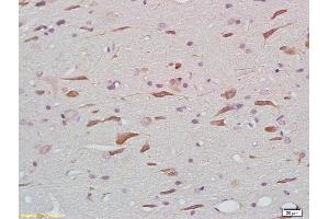 Formalin-fixed and paraffin embedded rat brain tissue labeled with Anti-phospho-Tau protein(Thr205) Polyclonal Antibody, Unconjugated (ABIN801813) at 1:200 followed by conjugation to the secondary antibody (tau antibody  (pThr212))