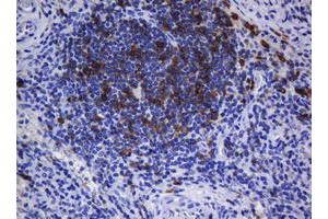 Immunohistochemistry (IHC) image for anti-T-cell surface glycoprotein CD1c (CD1C) antibody (ABIN2670676) (CD1c antibody)