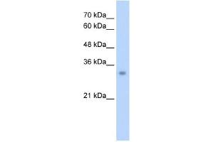 ECH1 antibody used at 2. (ECH1 antibody  (N-Term))