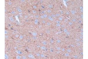 Immunohistochemistry (IHC) image for anti-Latexin (LXN) (AA 1-223) antibody (ABIN7442057)