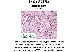Image no. 2 for anti-Actinin, alpha 2 (ACTN2) (AA 215-500) antibody (ABIN1731491)
