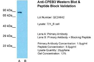 Host: Rabbit  Target Name: CPEB3  Sample Tissue: 721_B Whole Cell  Lane A:  Primary Antibody Lane B:  Primary Antibody + Blocking Peptide Primary Antibody Concentration: 1 µg/mL Peptide Concentration: 2 µg/mL Lysate Quantity: 241 µg/laneGel Concentration: 2. (CPEB3 antibody  (Middle Region))