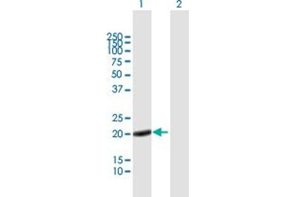 Calcyphosine antibody  (AA 1-189)